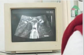 购买带老婆去医院做B超检查的B超仪，看到东西的CC神秘地带1V978M