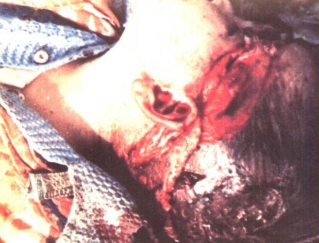 法医学真实图谱大合集