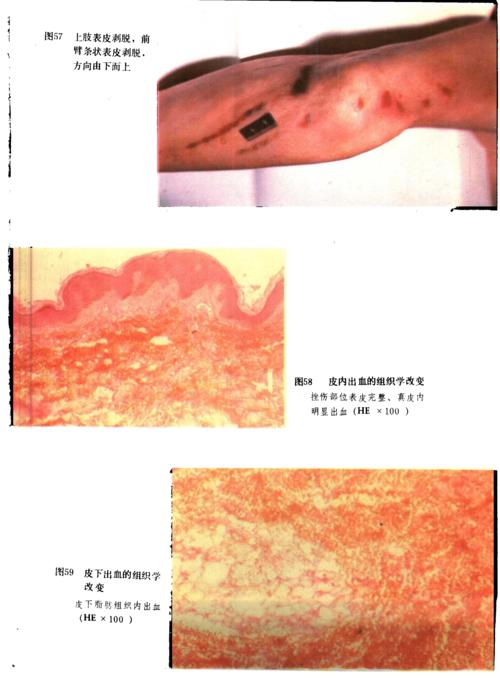 法医学真实图谱大合集