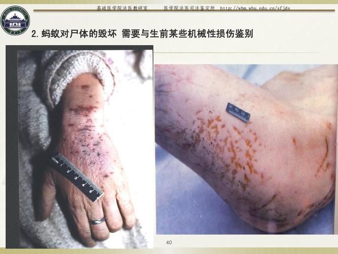 法医学真实图谱大合集