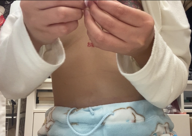 手术必备！乳钉实拍揭秘，点击即可获取百度盘下载！